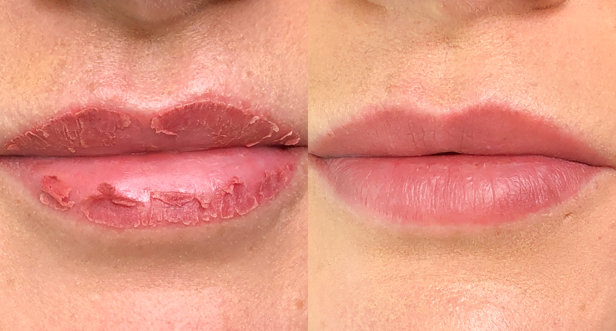 Lip Blush Healing Day by Day – Tina Davies UK - VAT # 229884558