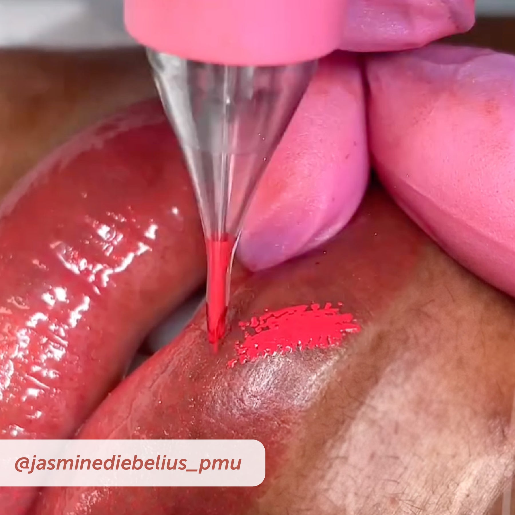 PIXL Needle Cartridge Sampler Pack