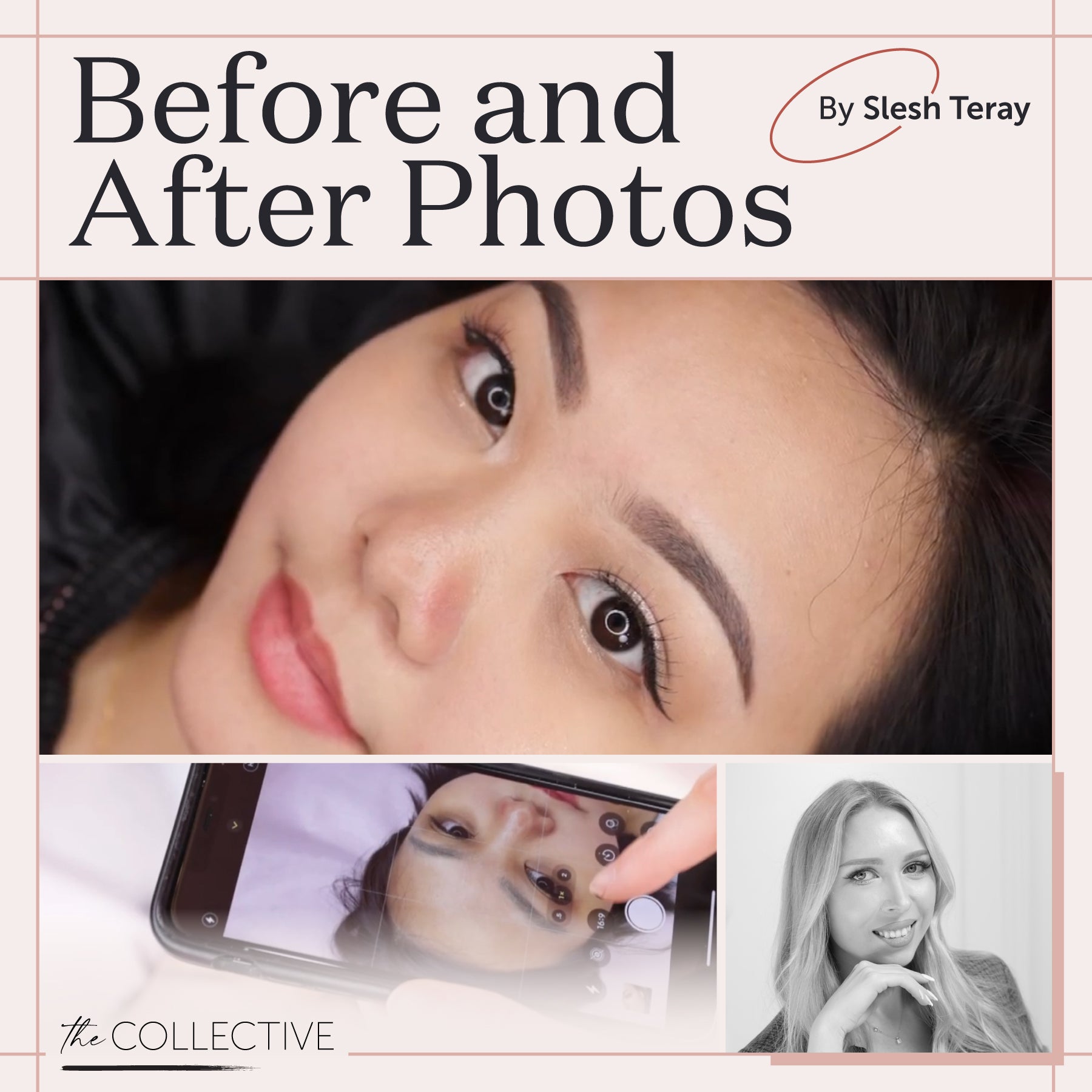Before and After Photos: Showcasing Your Results by Slesh Teray