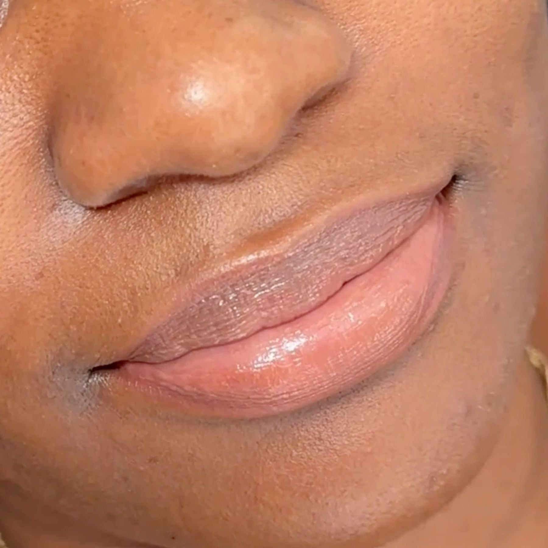 Fitz 6 Dark Lip Neutralization: Kurty’s Case Study