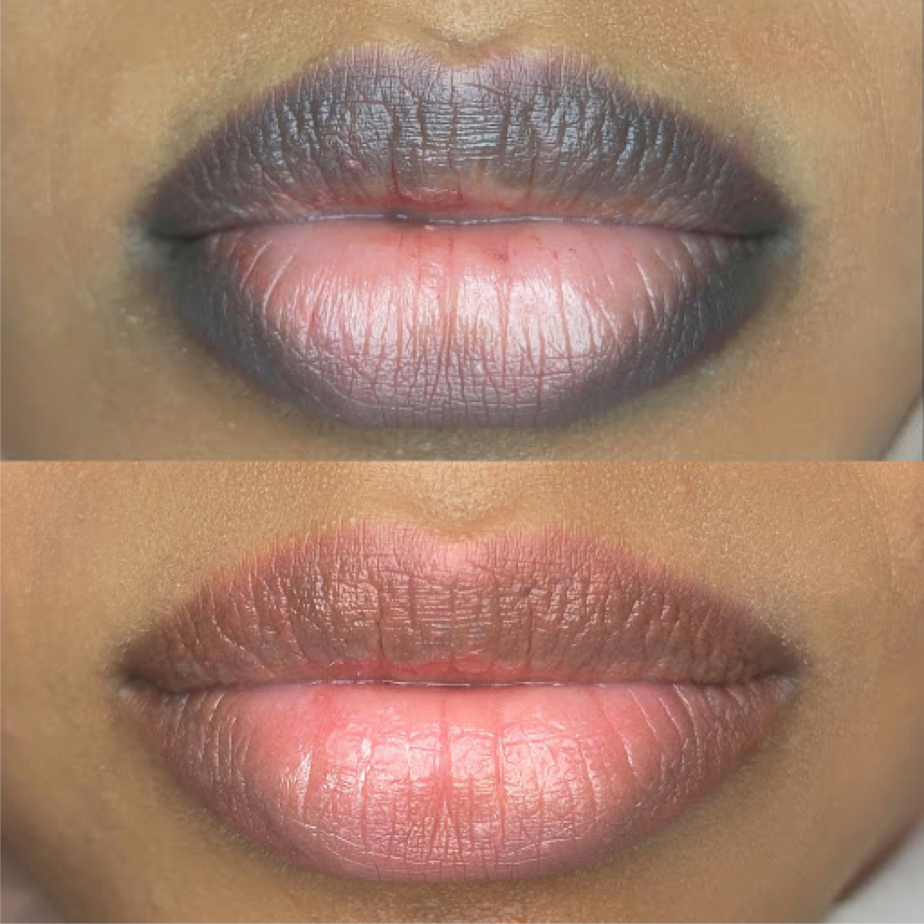 Lip Magic: Dark Lip Neutralization by Jasmine Diebelius