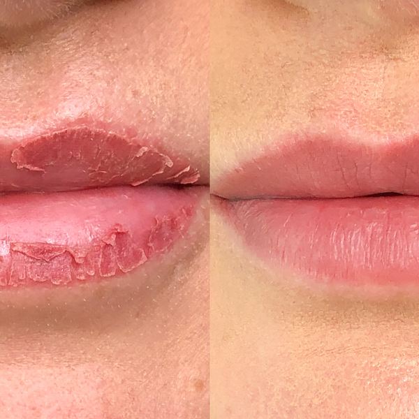 Lip Lining and Lip Blushing — Adorn Permanent Cosmetics & Microblading  Oakland