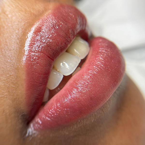 Lip Magic: Dark Lip Neutralization